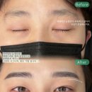 인천남자눈썹문신 성지 소개, 그린닷(내돈내산 후기)
