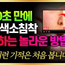 단 60초 만에 기미 색소침착 개선하는 놀라운 방법 깜짝 놀라실 겁니다 이미지