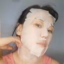 탄산팩 홈케어 클로레 스노우CO2솔루션키트 사용후기