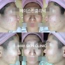 메이 스킨클리닉