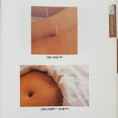 장삼침(腸三鍼) 이미지