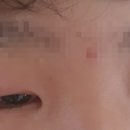 최숙경안과 네이버블로그