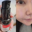 레드필 | 비건인증 레드 아크네 필 집에서 홈필링 하기 딱이에용 ‼️🎀 각질제거 끝판왕