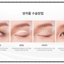 케이스성형외과의원 이미지