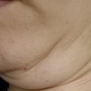 2612 | 텐써마 600샷 + 슈링크 300샷 내돈내산10일차 후기