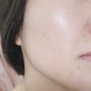 그린팜스테이 | 피부진정 팜스테이 티트리 바이옴 카밍 크림 워터 크림