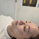 [마포구] 뮤즈뷰티에서 바이폴라 피부관리 받은 후기