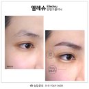 서면 자연눈썹후기, 엘레슈의원