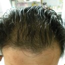 (주)젠셀 | (주)젠셀 - [싸이퍼키 헤어토닉] 5개월차 사용기~