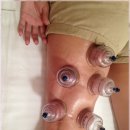 시작한의원 이미지