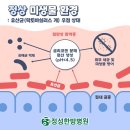정성한방병원 네이버블로그