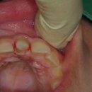 덴치과기공소 이미지