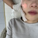 칠성시장역(지하철1호선) | 대구 신암동 피부관리 오블리제이 물방울 초음파 관리 후기