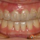 스마일라인치과기공소 이미지