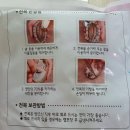 미쓰 참전복