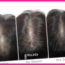 윤메디케어 | 가평속눈썹 가평 윤이나다, 내 감성과 피부 건강 모두 챙겨주네요!
