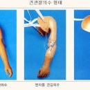 현대의수족 이미지