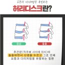 경산에스(S)한의원 | 경산허리디스크 통증, 다리 저림이 반복된다면 필독하세요