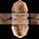 가까운치과기공소 이미지