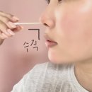 서호개발 - 3969 | 서울 비염 잘하는 병원 추천 강남 라경찬한의원 만성 비염치료 상담부터 치료까지 다녀온 솔직 후기
