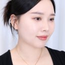 송도피부과 고주파리프팅 가격 효과 통증 써니RF 후기