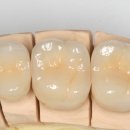 신테크치과기공소 이미지