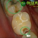 허브치과 이미지