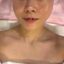 엘리아헤어 | 삼성동 피부관리 추천, 삼성역 더윤에스테틱 근막관리 솔직후기