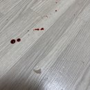 고미발톱 이미지