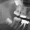 서울배치과의원 이미지