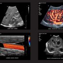 Philips EPIQ 7 Ultrasound Machine 이미지