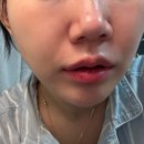 메디포뮬러 | 에스테인 메디포뮬러 앰플 솔직 후기 : 119앰플과 보톡스에센스의 만남