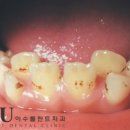 서울이수플란트치과의원 이미지