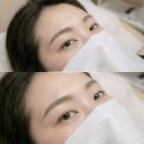 코리아 코리아 고려~ | 인천 송도 눈썹문신 잘하는곳 유미코리아 뷰티센터 후기