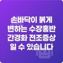 경화약국 | 손바닥이 붉게 변하는 수장홍반 간경화 전조증상일 수 있습니다