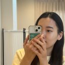 홍 헤어라인 네이버블로그