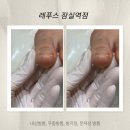 잠실역 | 잠실 발톱무좀 레푸스 잠실역점 기본정리 후기