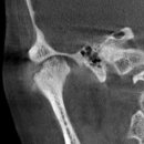 역삼-1744 이미지