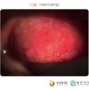 부산콘택트렌즈
