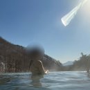멍이날개 | [내돈내산] 팔뚝 무한람스 당일~4일차 후기 (예신관리)