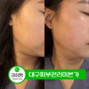 대구 피부관리 미본가 | 감삼동 대구 피부관리 미본가 얼굴 라인 관리 후기