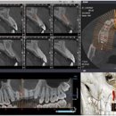 수플란트치과병원 이미지