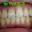허브치과 이미지