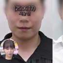 범계예쁨주의쁨의원 이미지