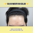 라인종합광고