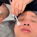 별빛손 에스테틱 | 예쁘다에스테틱 재방문 후기1년 만에 다시 받아본 어븀아그레이저 관리 솔직후기