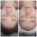 순환로1L | [청주피부미용학원 에르벨에스테틱청주분평점] 청주 분평동 뱀부윤곽관리 후기