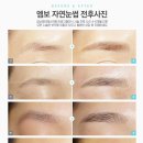 제이에스메디 이미지