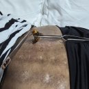 2026년 첫 중탱이 장수말벌침을 맞았답니다 이미지