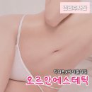 에스테틱오르 | 세종 피부관리 오르안에스테틱 복부 티리온X 16만줄 후기, 촬영 전 필수 코스인 이유